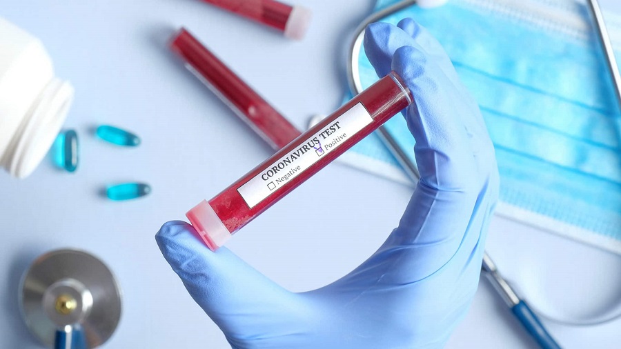 secondo caso di Coronavirus