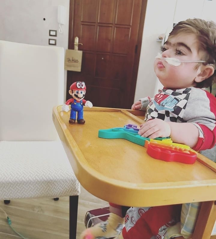 Storia di Mario, un bimbo con una malattia rara, 30 casi al mondo